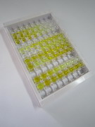 促甲狀腺素受體(TSHR)檢測(cè)試劑盒(酶聯(lián)免疫吸附試驗(yàn)法)