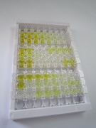 分泌粒蛋白Ⅴ(SCG5)检测试剂盒(酶联免疫吸附试验法)