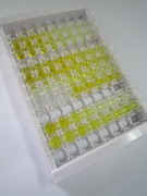 嗜铬蛋白B(CHGB)检测试剂盒(酶联免疫吸附试验法)