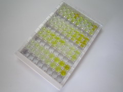 輕肽鐵蛋白(FTL)檢測(cè)試劑盒(酶聯(lián)免疫吸附試驗(yàn)法)