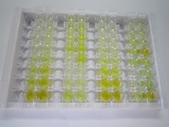 核糖核酸酶L(RNASEL)检测试剂盒(酶联免疫吸附试验法)