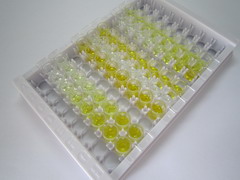EB病毒诱导蛋白3(EBI3)检测试剂盒(酶联免疫吸附试验法)
