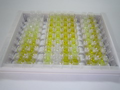 补体成分1q子成分B(C1qB)检测试剂盒(酶联免疫吸附试验法)