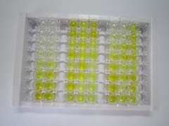 心肌肌钙蛋白T(TNNT2)检测试剂盒(酶联免疫吸附试验法)