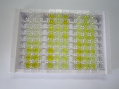 細(xì)胞色素P450家族成員1B1(CYP1B1)檢測(cè)試劑盒(酶聯(lián)免疫吸附試驗(yàn)法)