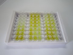 細(xì)胞色素P450家族成員11B1(CYP11B1)檢測(cè)試劑盒(酶聯(lián)免疫吸附試驗(yàn)法)