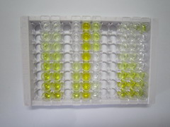 ⅡA组磷脂酶A2(PLA2G2A)检测试剂盒(酶联免疫吸附试验法)