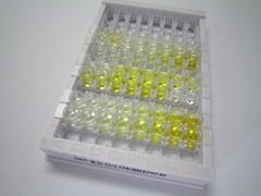 二甲基精氨酸二甲胺水解酶2(DDAH2)检测试剂盒(酶联免疫吸附试验法)