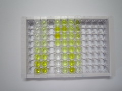 蛋白磷酸酶1调节因子亚基1B(PPP1R1B)检测试剂盒(酶联免疫吸附试验法)
