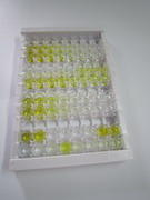胰辅脂酶(CLPS)检测试剂盒(酶联免疫吸附试验法)