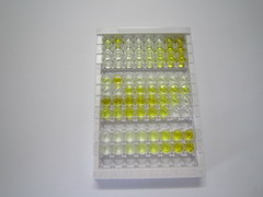 泛素结合酶E2C结合蛋白E2I(UBE2I)检测试剂盒(酶联免疫吸附试验法)