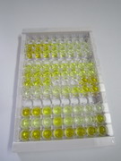 FK506結(jié)合蛋白5(FKBP5)檢測(cè)試劑盒(酶聯(lián)免疫吸附試驗(yàn)法)