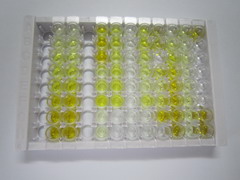 亲核素β(KPNb1)检测试剂盒(酶联免疫吸附试验法)