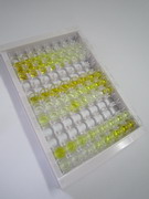 膜联蛋白A10(ANXA10)检测试剂盒(酶联免疫吸附试验法)