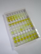 膜聯(lián)蛋白A1(ANXA1)檢測(cè)試劑盒(酶聯(lián)免疫吸附試驗(yàn)法)