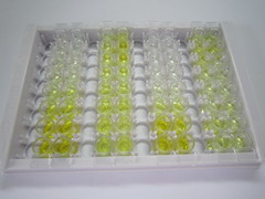 核受体辅抑制因子1(NCOR1)检测试剂盒(酶联免疫吸附试验法)