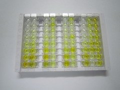晶状体蛋白βA1(CRYbA1)检测试剂盒(酶联免疫吸附试验法)