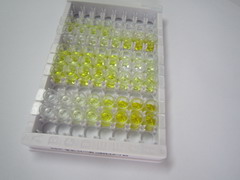 晶状体蛋白βB2(CRYbB2)检测试剂盒(酶联免疫吸附试验法)