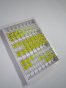白细胞衍生趋化因子2(LECT2)检测试剂盒(酶联免疫吸附试验法)