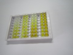 非红细胞血影蛋白β4(SPTbN4)检测试剂盒(酶联免疫吸附试验法)