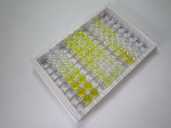 糖原合酶2(GYS2)檢測(cè)試劑盒(酶聯(lián)免疫吸附試驗(yàn)法)