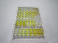 硒结合蛋白1(SELENBP1)检测试剂盒(酶联免疫吸附试验法)