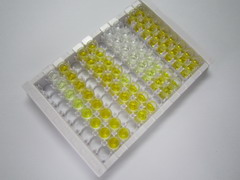 受體酪氨酸激酶樣孤兒素受體1(ROR1)檢測(cè)試劑盒(酶聯(lián)免疫吸附試驗(yàn)法)