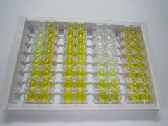 芳基硫酸酯酶A(ARSA)检测试剂盒(酶联免疫吸附试验法)