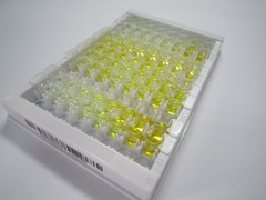 UDP葡糖醛酸基转移酶1家族多肽A1(UGT1A1)检测试剂盒(酶联免疫吸附试验法)