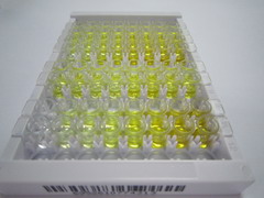 转酮醇酶样蛋白1(TKTL1)检测试剂盒(酶联免疫吸附试验法)