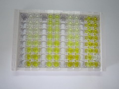 絲氨酸肽酶抑制因子Kazal型1(SPINK1)檢測試劑盒(酶聯(lián)免疫吸附試驗法)