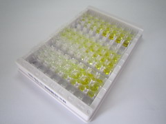 配对框基因9(PAX9)检测试剂盒(酶联免疫吸附试验法)