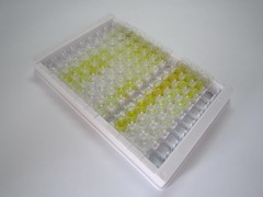 N-乙酰半乳糖胺酶α(NAGa)檢測(cè)試劑盒(酶聯(lián)免疫吸附試驗(yàn)法)