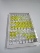 甲型肝炎病毒细胞受体2(HAVCR2)检测试剂盒(酶联免疫吸附试验法)