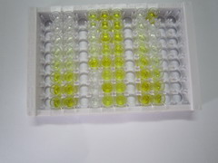 鸟苷酸环化酶1β3(GUCY1b3)检测试剂盒(酶联免疫吸附试验法)