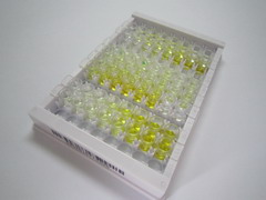 脆性X智力遲鈍蛋白1(FMR1)檢測試劑盒(酶聯(lián)免疫吸附試驗法)