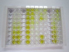 嗜酸性粒细胞过氧化物酶(EPX)检测试剂盒(酶联免疫吸附试验法)