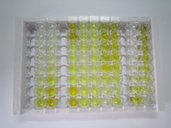 DNA甲基转移酶3B(DNMT3B)检测试剂盒(酶联免疫吸附试验法)