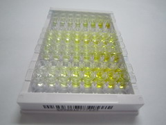 B-细胞κ-轻肽基因增强子抑制因子激酶β(IkBKb)检测试剂盒(酶联免疫吸附试验法)