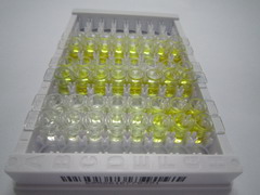 视网膜劈裂蛋白(RS)检测试剂盒(酶联免疫吸附试验法)