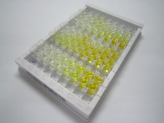 C1q肿瘤坏死因子相关蛋白3(C1QTNF3)检测试剂盒(酶联免疫吸附试验法)