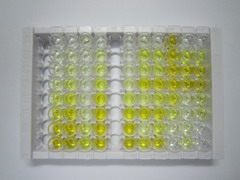 再生胰岛衍生蛋白3β(REG3b)检测试剂盒(酶联免疫吸附试验法)