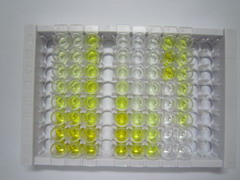CD5抗原样蛋白(CD5L)检测试剂盒(酶联免疫吸附试验法)