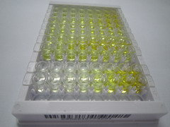 细胞色素P450家族成员4F2(CYP4F2)检测试剂盒(酶联免疫吸附试验法)