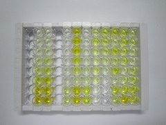 δ样蛋白1同源物(dLK1)检测试剂盒(酶联免疫吸附试验法)