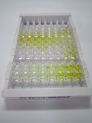 cAMP依赖性蛋白激酶调节因子Ⅱβ(PRKAR2b)检测试剂盒(酶联免疫吸附试验法)
