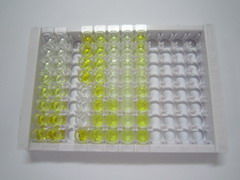 R-脊椎蛋白2(RSPO2)检测试剂盒(酶联免疫吸附试验法)