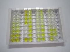 类固醇5α还原酶2(SRD5a2)检测试剂盒(酶联免疫吸附试验法)
