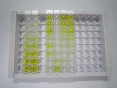牙骨质蛋白1(CEMP1)检测试剂盒(酶联免疫吸附试验法)