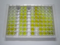 含胶原三螺旋重复蛋白1(CTHRC1)检测试剂盒(酶联免疫吸附试验法)
